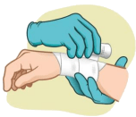 5 basic principles for the management of a wound – Fibroheal