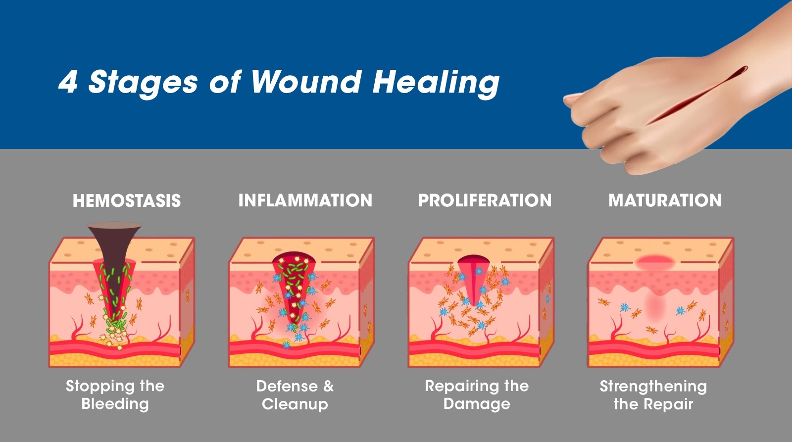 Wound healing Stages