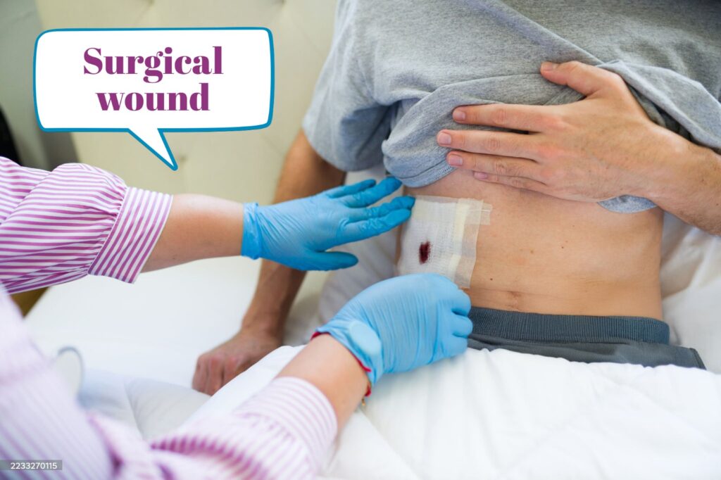 Surgical Wounds: Types, Causes & Diagnosis