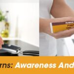 Kitchen Burns: Precautions And Remedies