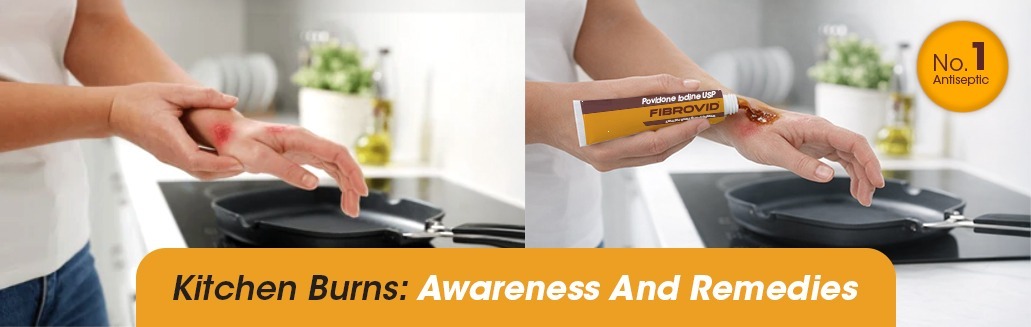 Kitchen Burns: Precautions And Remedies