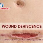 Wound Dehiscence