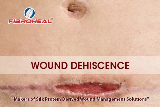 Wound Dehiscence